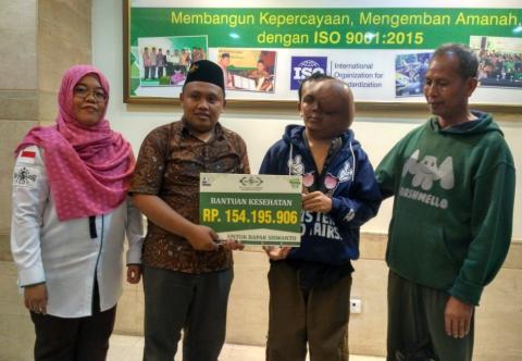 Alhamdulillah, Harapan Itu Mendatangi Siswanto Penderita Tumor di Wajahnya