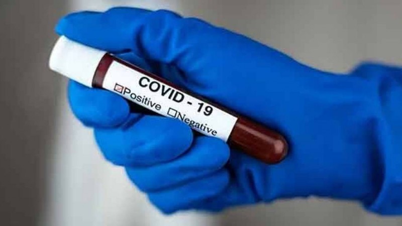 Obat Anti-Virus Corona