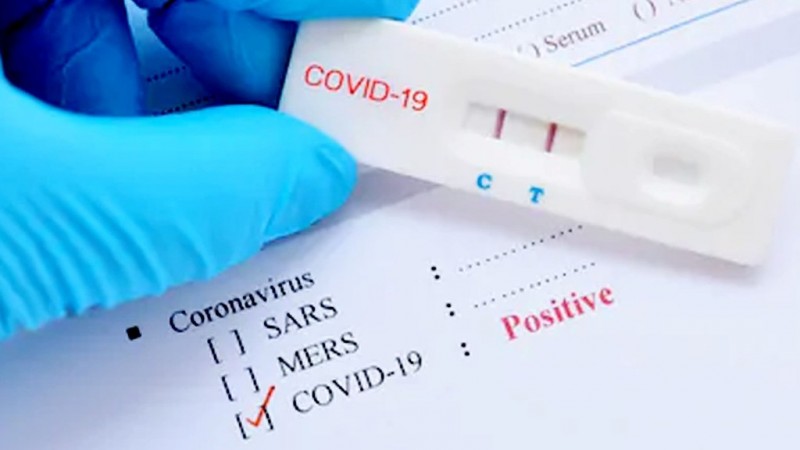 Letak Kekurangan Rapid Test untuk Deteksi Virus Corona
