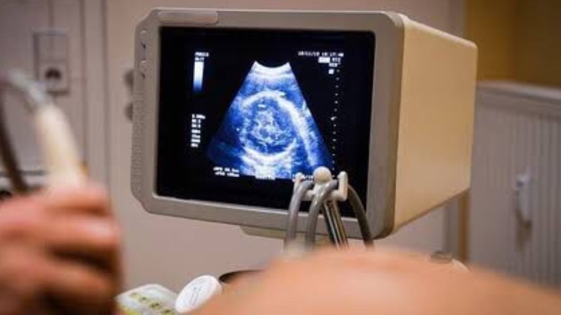 Risiko Kehamilan Usia Remaja Sebabkan Kematian Ibu dan Anak