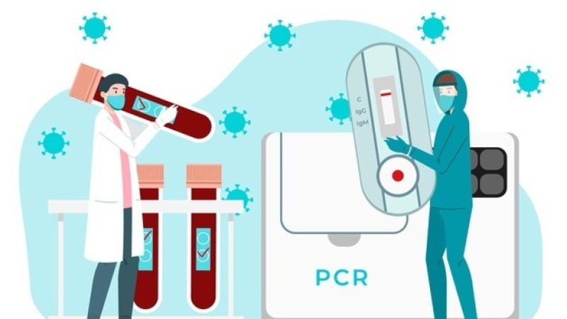 Dirut Bio Farma Ungkap Harga Reagen Tes PCR Hanya Rp90 Ribu