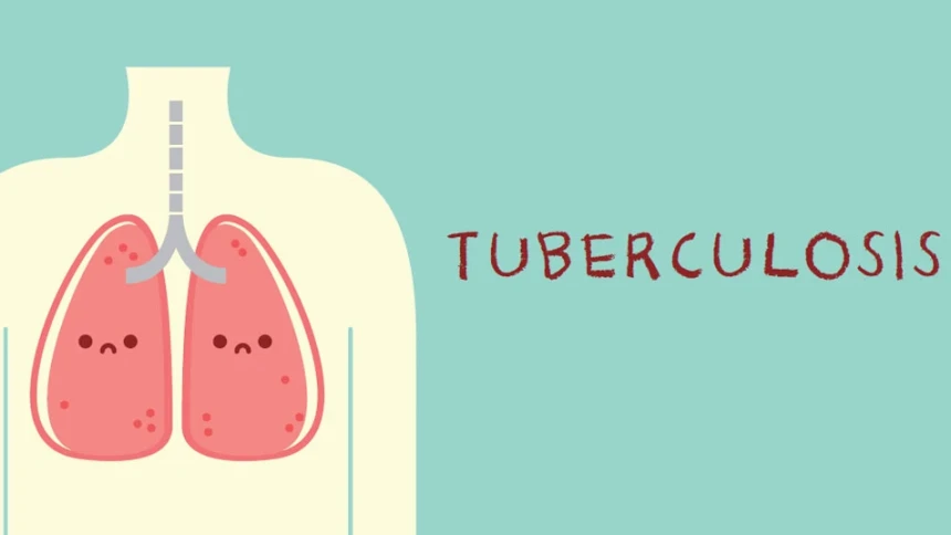 Hindari TBC dengan Perbaiki Ventilasi Rumah untuk Sirkulasi Udara