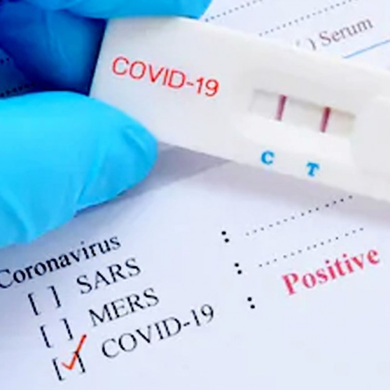 Letak Kekurangan Rapid Test untuk Deteksi Virus Corona