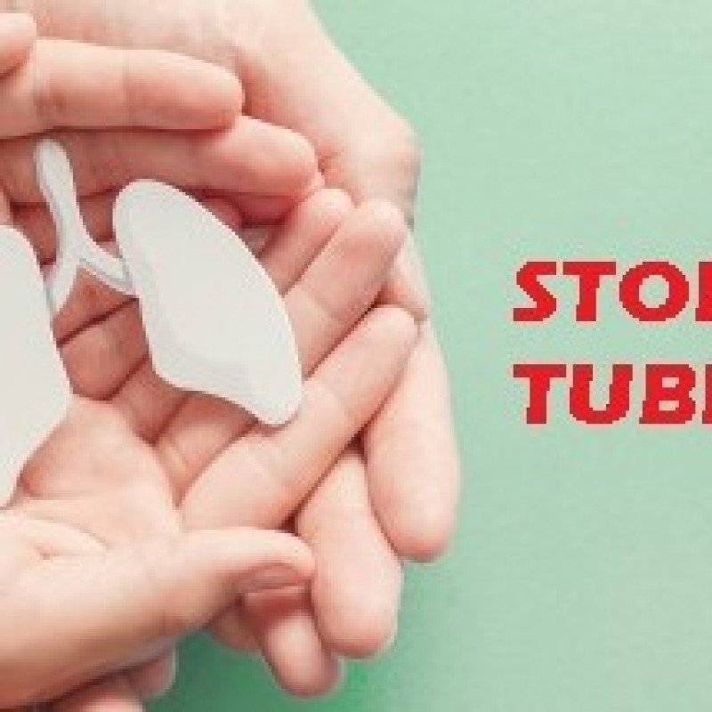 LKNU Serang Raya Perkuat Peran Kader dalam Tangani Tuberculosis