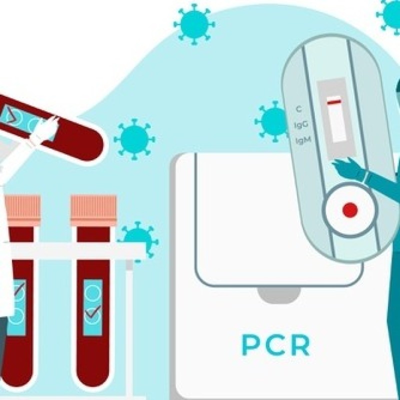 Dirut Bio Farma Ungkap Harga Reagen Tes PCR Hanya Rp90 Ribu