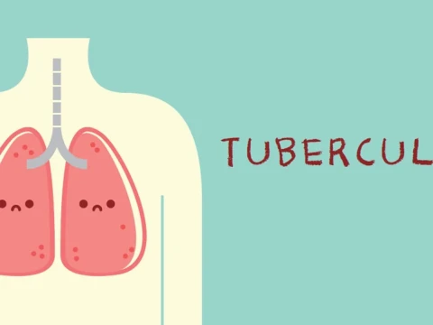 Hindari TBC dengan Perbaiki Ventilasi Rumah untuk Sirkulasi Udara